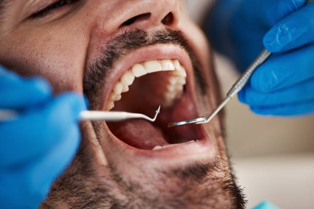 Best Emergency Dentist for Special Needs Patients in Drexel, NC