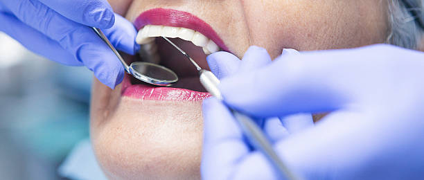 Best Emergency Root Canal Treatment in Drexel, NC